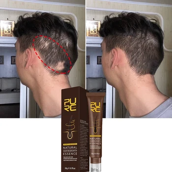 PURC Продукти за растеж на косата за мъже Джинджифил против косопад Масло за бързо прераждане Сгъстяване на серума за лечение на скалпа за жени Грижа за косата