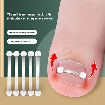Инструменти за нокти на краката Педикюр Възстановяване на вграждане на нокти на пръстите на краката Професионален врастнал инструмент за корекция на ноктите на краката