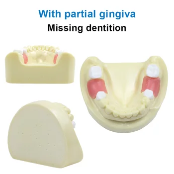 Модел на зъбни зъби Максиларен имплантен модел с частична гингива за стоматолог Студентско обучение Дентален инструмент